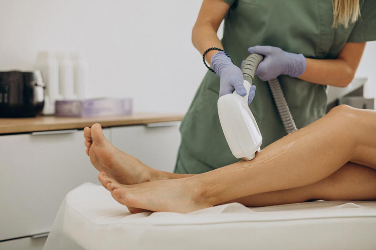 laser hair removal